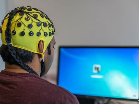 How The Idea Of A Brain Museum Came Into Existence