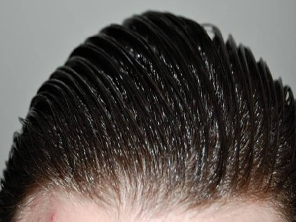 ஆயில் நாட் அலோட்