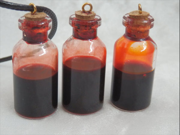 4. రక్తపు సీసాలను వేలాడ దీసేవారు